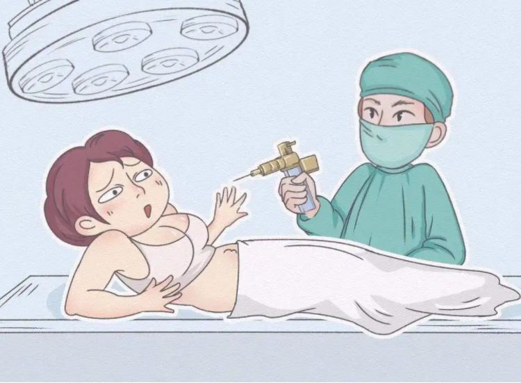 全身抽脂對身體有什么傷害？